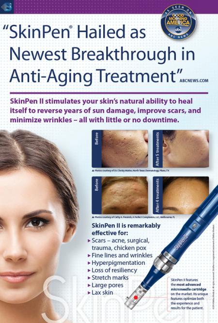 Skin Pen Microneedling Treatment, Dallas TX | Facial Treatment, Skin ...